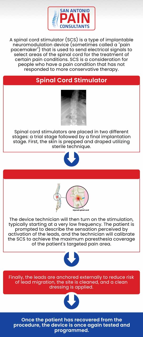 Spinal Cord Stimulation for Pain Management in San Antonio, TX